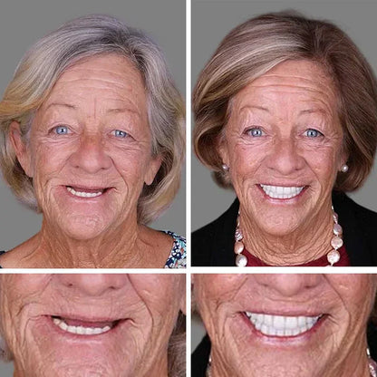 🌎Ends Today: 70% OFF! ⏰ Medical Full Denture with Strong Suctiond🦷Obtain American Dental Association (ADA) Certification