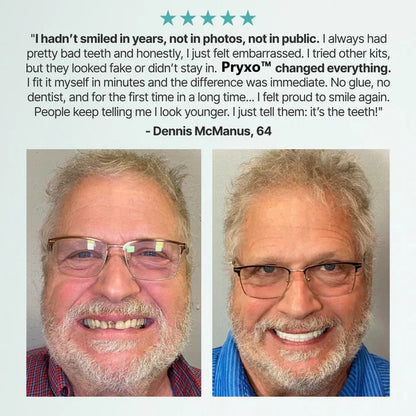 🌎Ends Today: 70% OFF! ⏰ Custom-Fit Full Functional Dentures Make you more confident